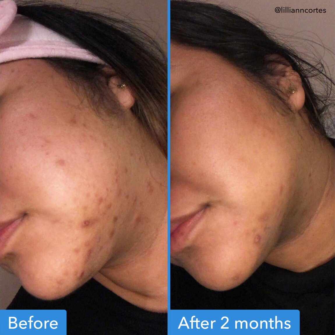 discoloration-correcting-serum-o4 zb_p.jpg