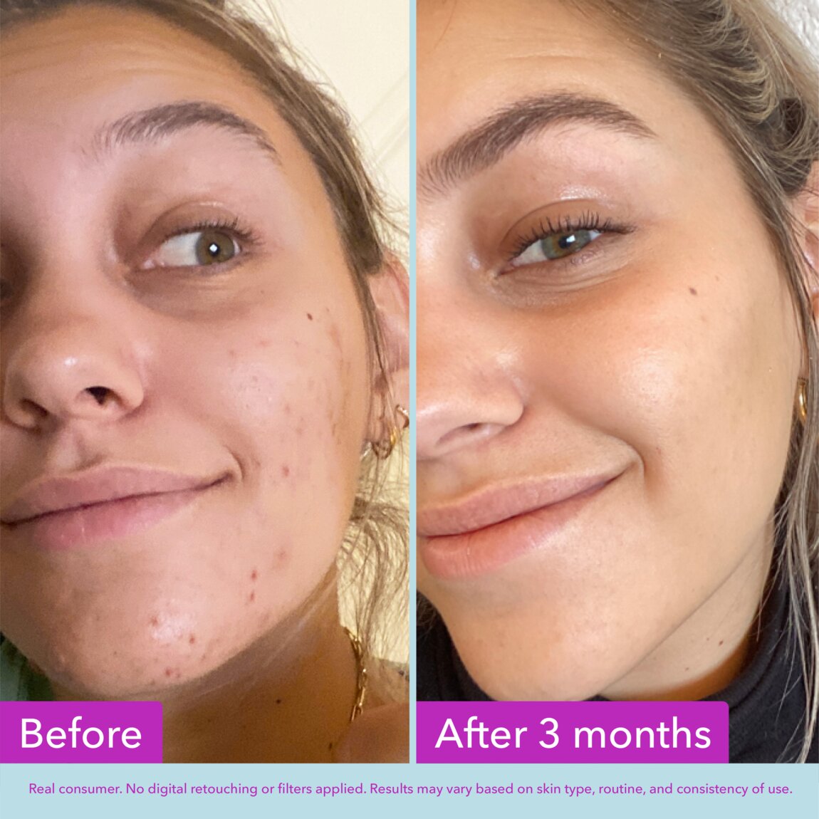 niacinamide-brightening-toner-q9 zb_p.jpg