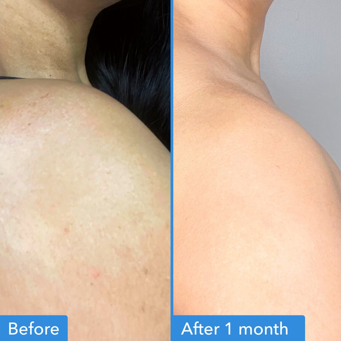 discoloration-correcting-body-treatment-y1 zb_p.jpg